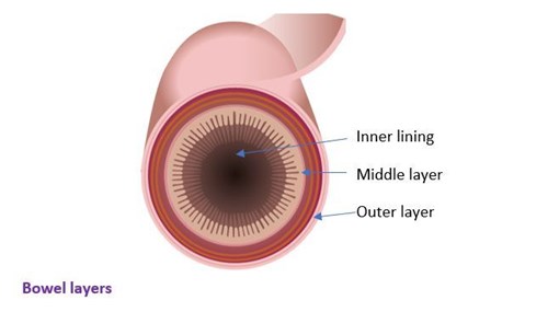 bowel layers graphic