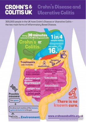 infographic